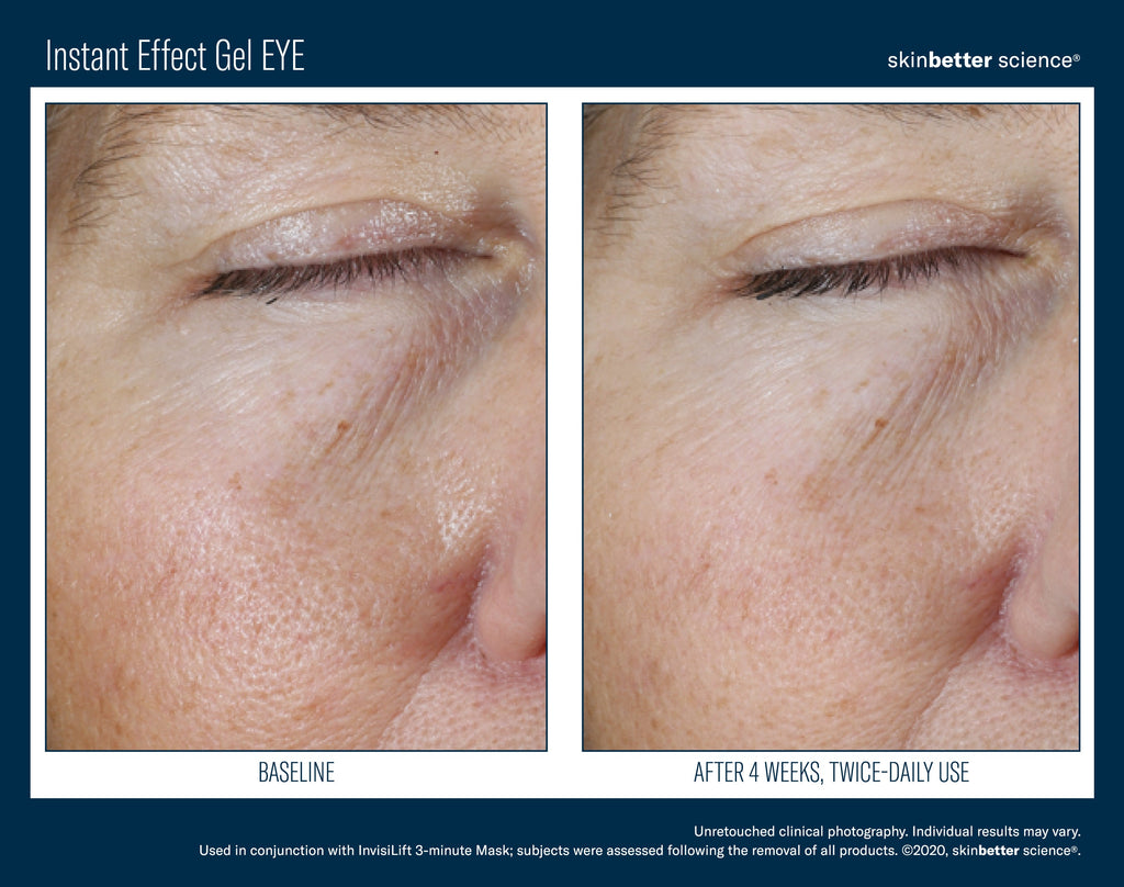 Instant Effect Gel EYE