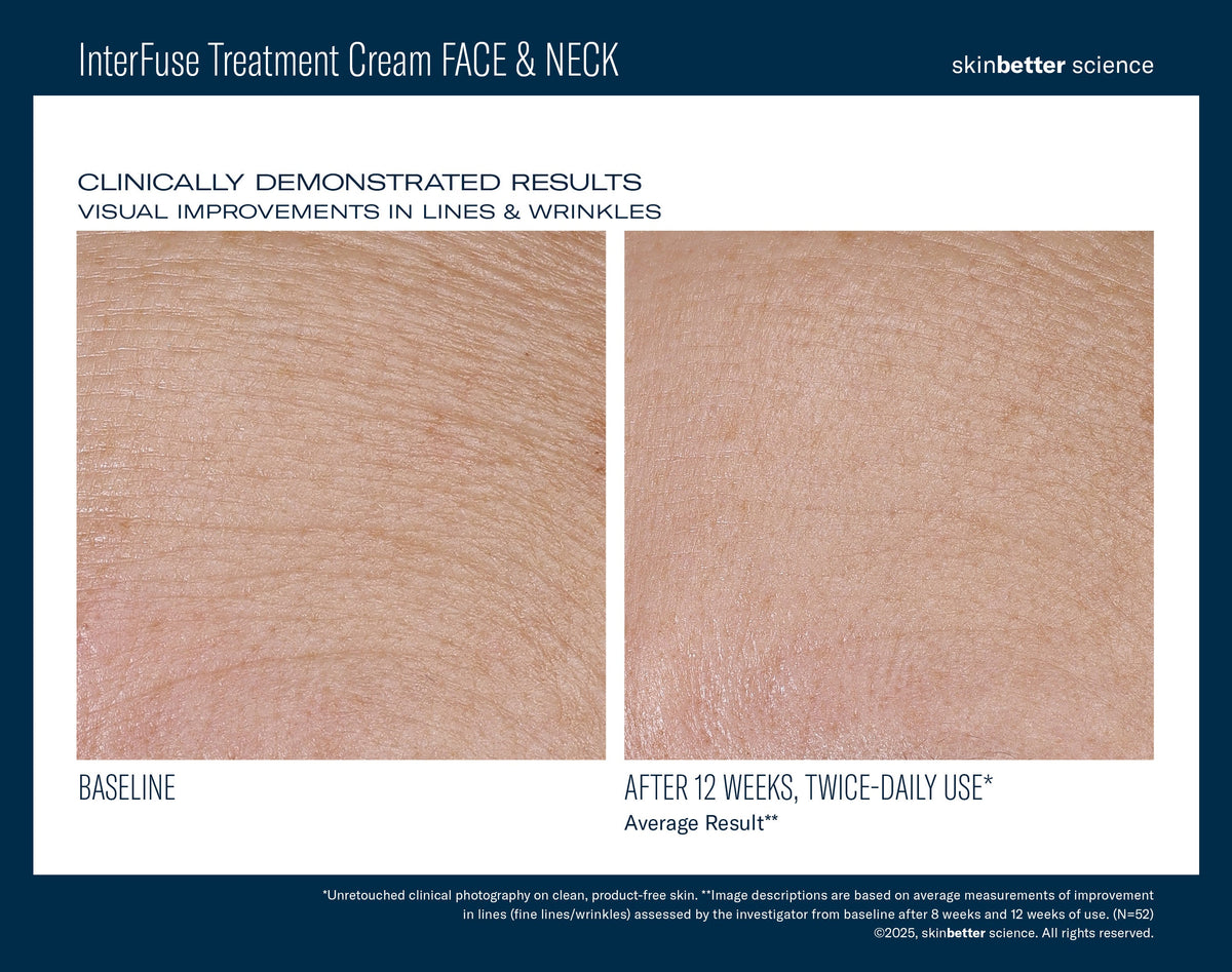 InterFuse Treatment Cream FACE & NECK 30 ml