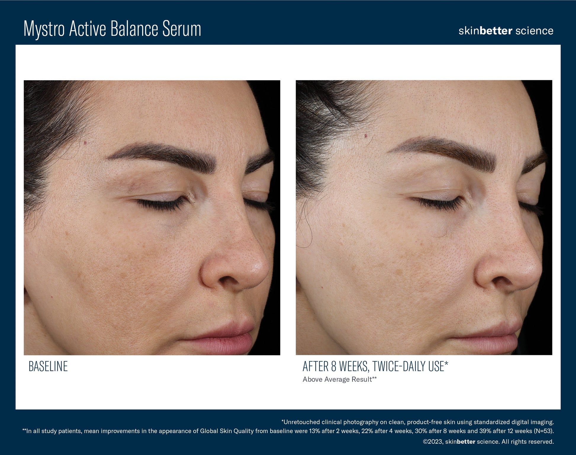 Mystro Active Balance Serum 50 ml