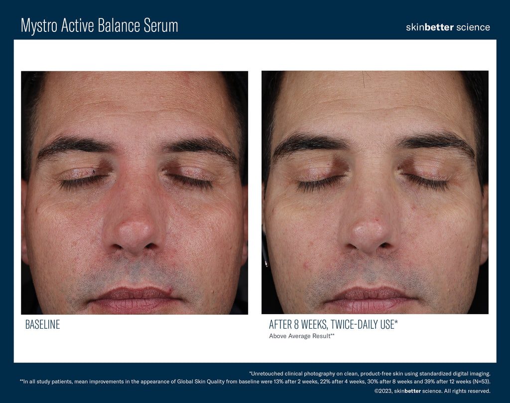 Mystro Active Balance Serum 50 ml