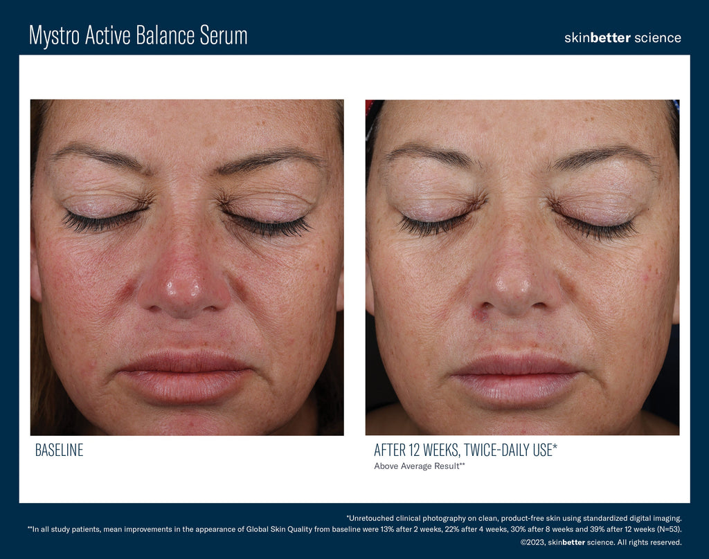 Mystro Active Balance Serum 30 ml