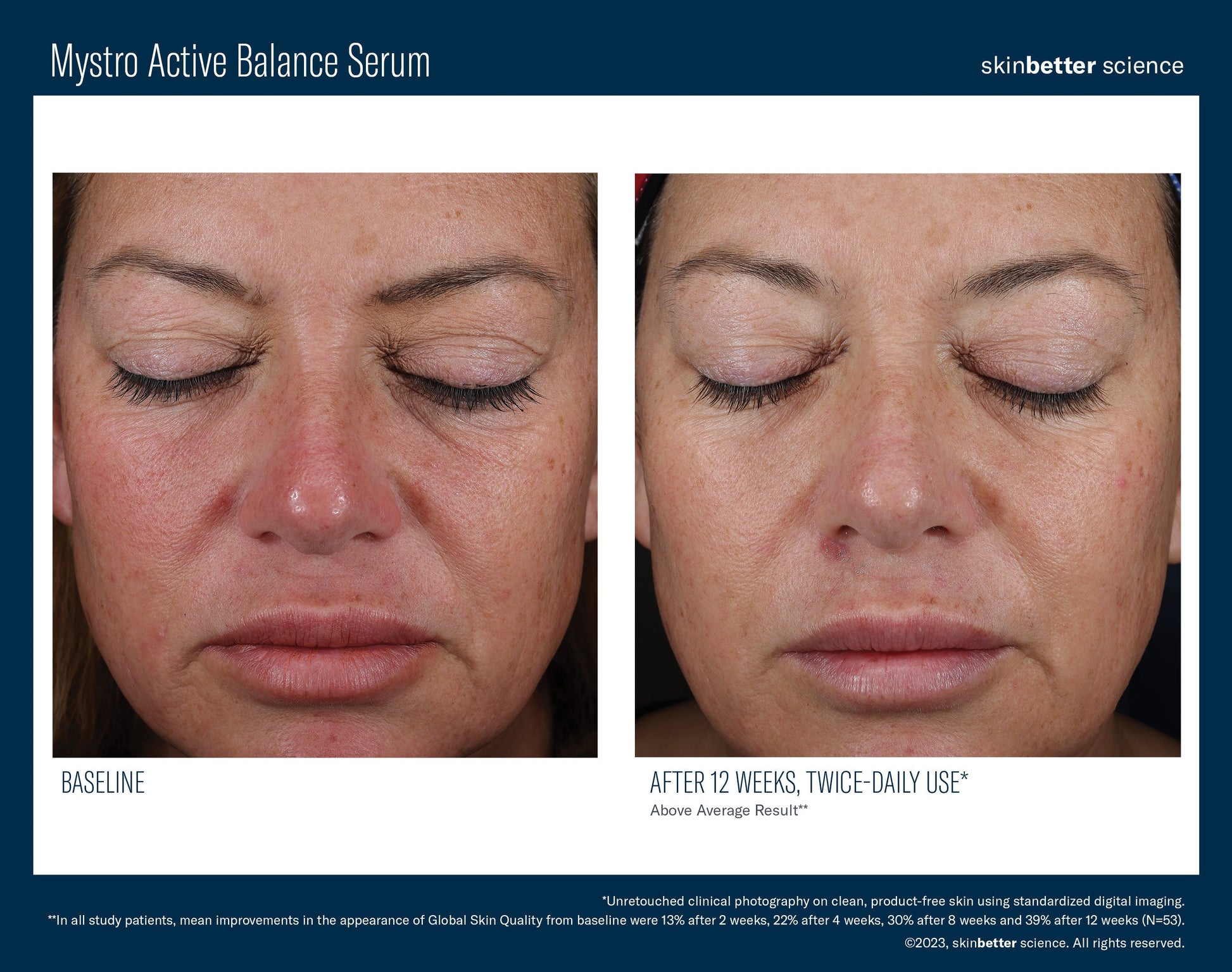 Mystro Active Balance Serum 50 ml