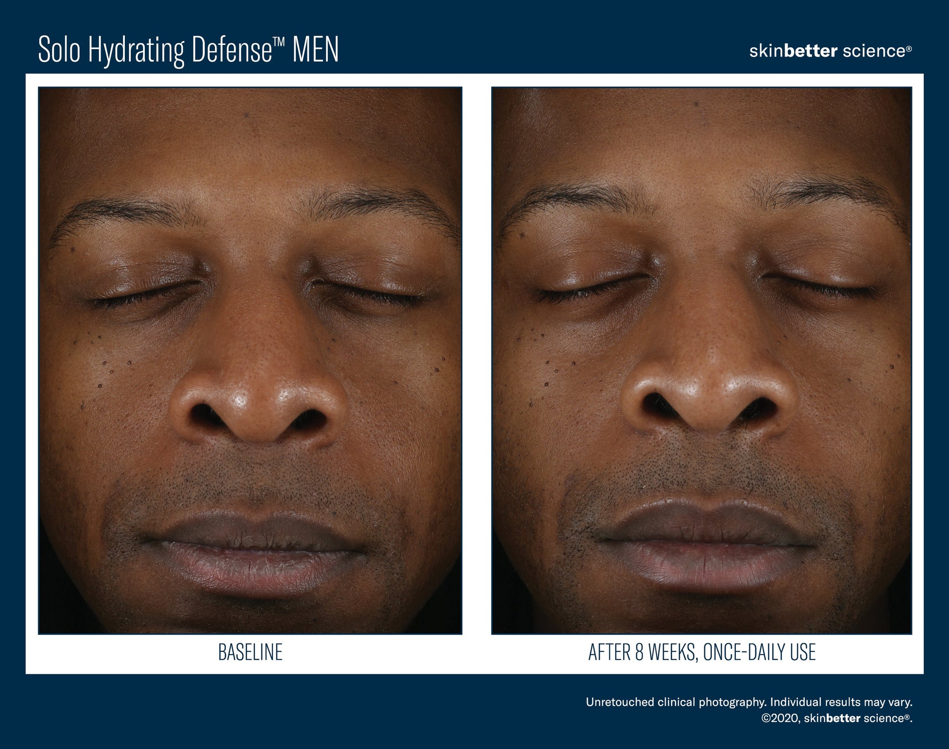 Solo Hydrating Defense MEN
