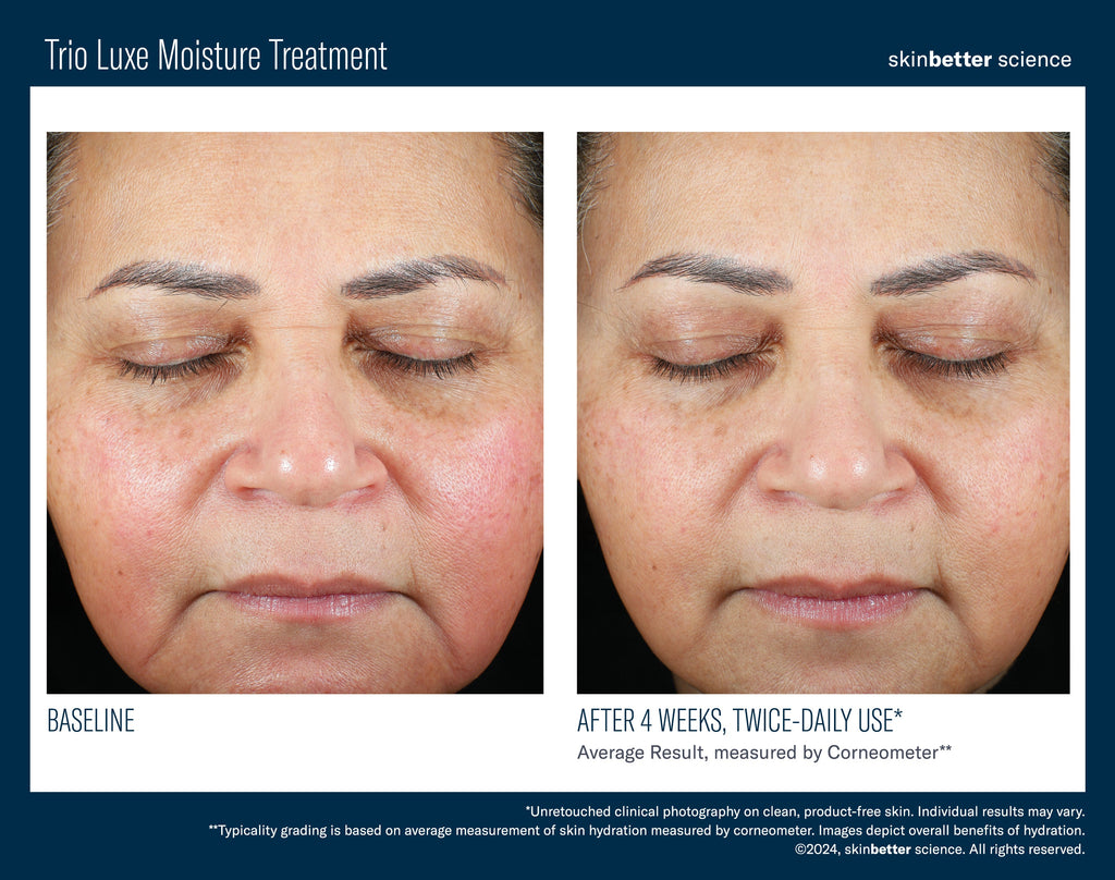 Trio Luxe Moisture Treatment