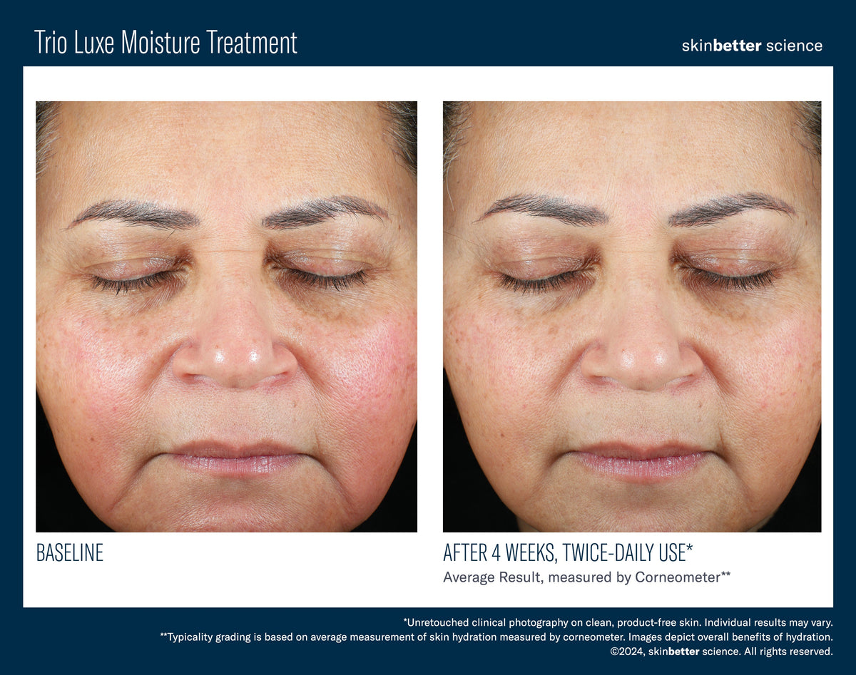 Trio Luxe Moisture Treatment