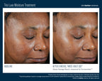Trio Luxe Moisture Treatment