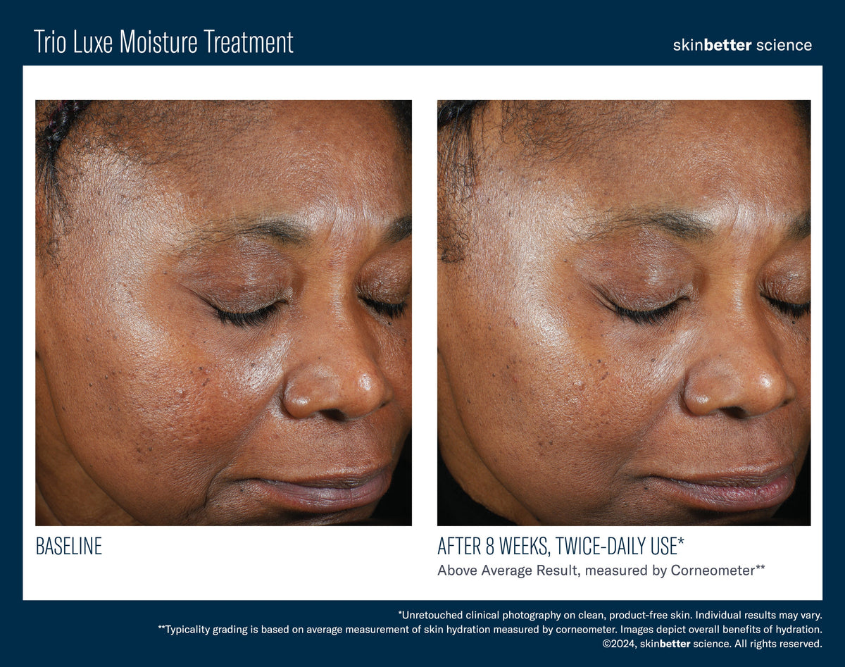 Trio Luxe Moisture Treatment