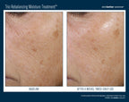 Trio Rebalancing Moisture Treatment