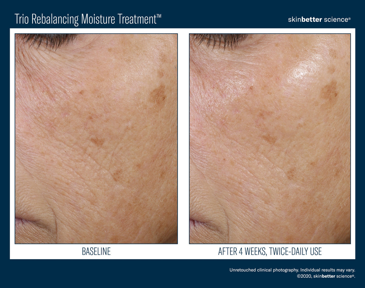 Trio Rebalancing Moisture Treatment